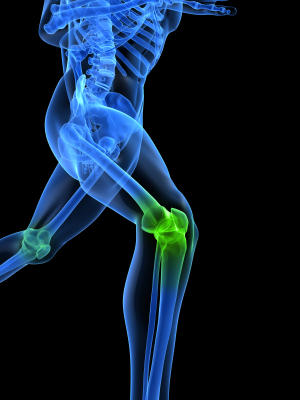 Knie